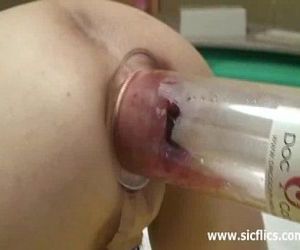 XXL anal vacuum pumping and brutal fisting - 8 min