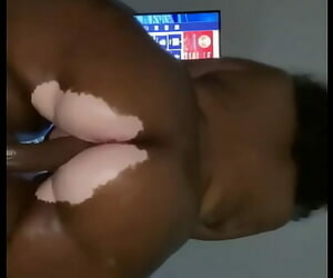 Vitiligo instagram 모델 liyahthebunni lubed 한 엉덩이